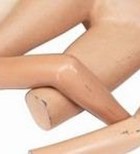 ניתוחים לתיקון הבקע: אפשר לסתום בפקק-תמונה ניתוחים לתיקון הבקע: אפשר לסתום בפקק-תמונה