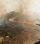 שריפה: טיפול בכוויות ושאיפת עשן-תמונה שריפה: טיפול בכוויות ושאיפת עשן-תמונה