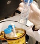מחלת קרוהן - Crohn Disease מחלת קרוהן - Crohn Disease