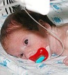 14 אלף פגים נולדים מדי שנה-תמונה 14 אלף פגים נולדים מדי שנה-תמונה