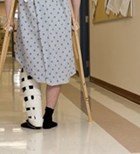 לראשונה: מסמר פחם בקיבוע שבר-תמונה לראשונה: מסמר פחם בקיבוע שבר-תמונה