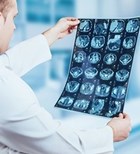 קרני רנטגן (קרני X) X-ray-תמונה קרני רנטגן (קרני X) X-ray-תמונה