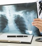 דימות: חשיבות הדעה הנוספת-תמונה דימות: חשיבות הדעה הנוספת-תמונה