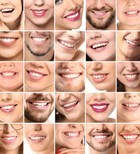 Smile Design – להדגשת החן שבחיוך-תמונה Smile Design – להדגשת החן שבחיוך-תמונה
