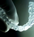 פלטות נשלפות לשיניים - תמונת המחשה
