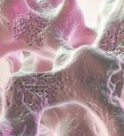 בריחת סידן – כיצד נמנעים ומטפלים באוסטיאופורוזיס?-תמונה בריחת סידן – כיצד נמנעים ומטפלים באוסטיאופורוזיס?-תמונה